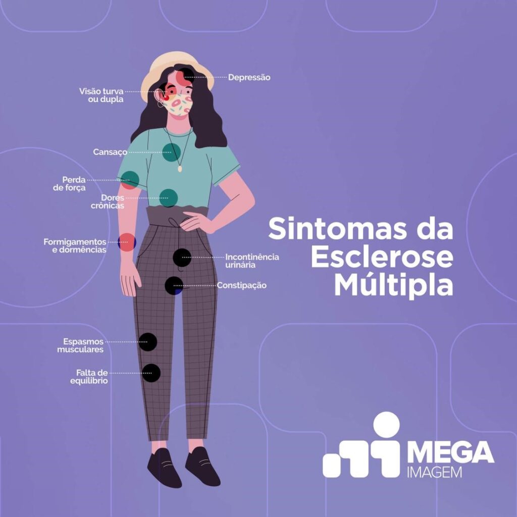 sintomas-esclerose-múltipla