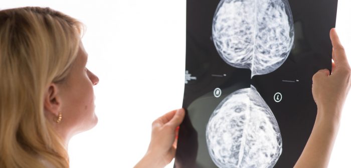 Qual a diferença de mamografia e ultrassom de mamas?