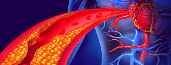 Colesterol: o que é, quais os sintomas e como controlar