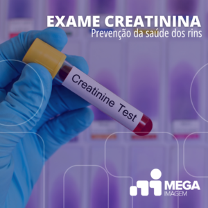 exame-creatinina