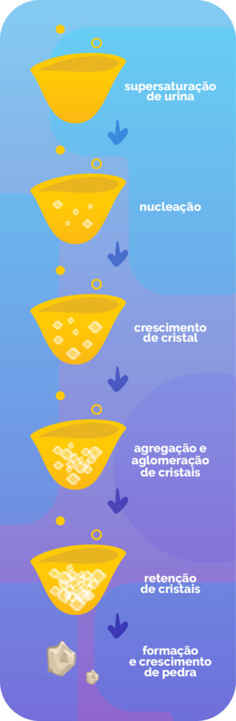 calculo-renal