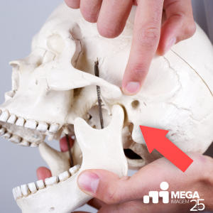 Mandíbula e Articulação Temporomandibular