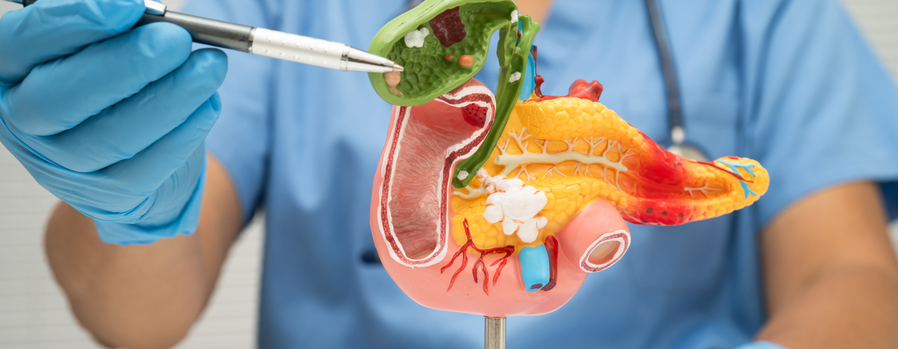 Câncer de Estômago: entenda mais sobre a doença