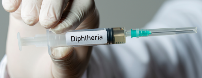 Difteria: o que é, sintomas e tratamentos