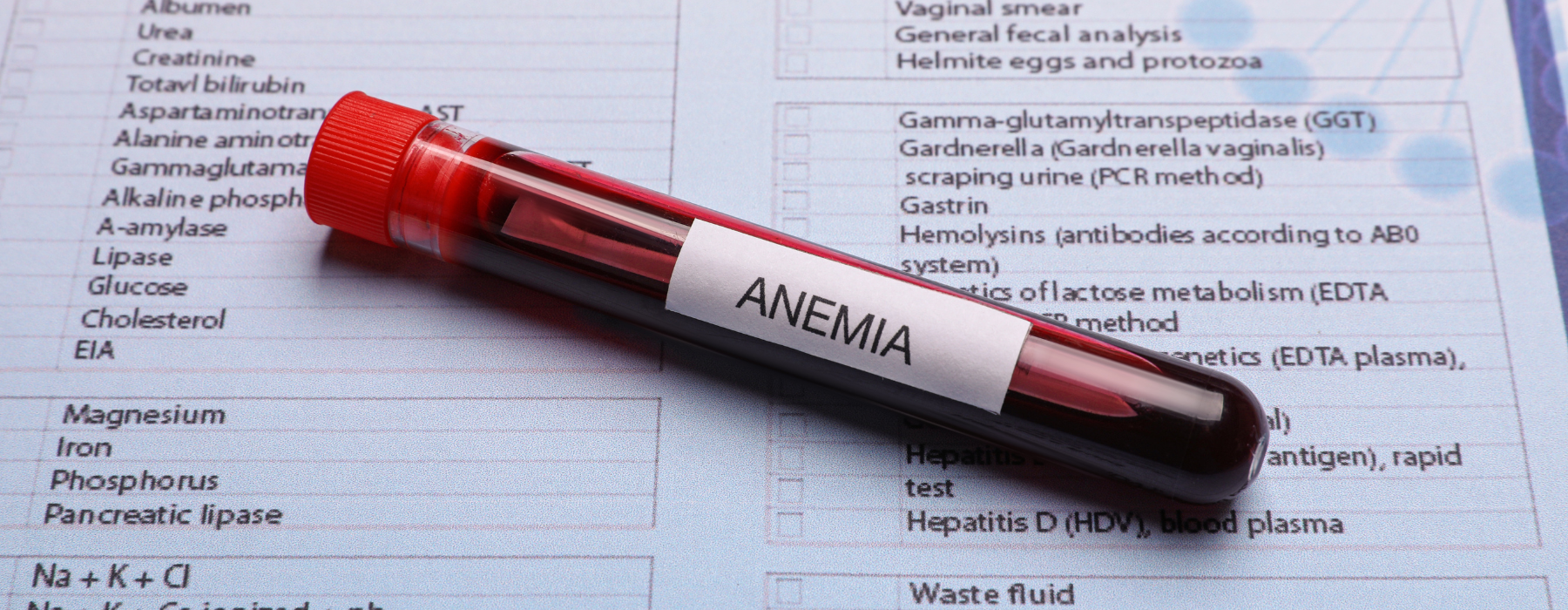 anemia