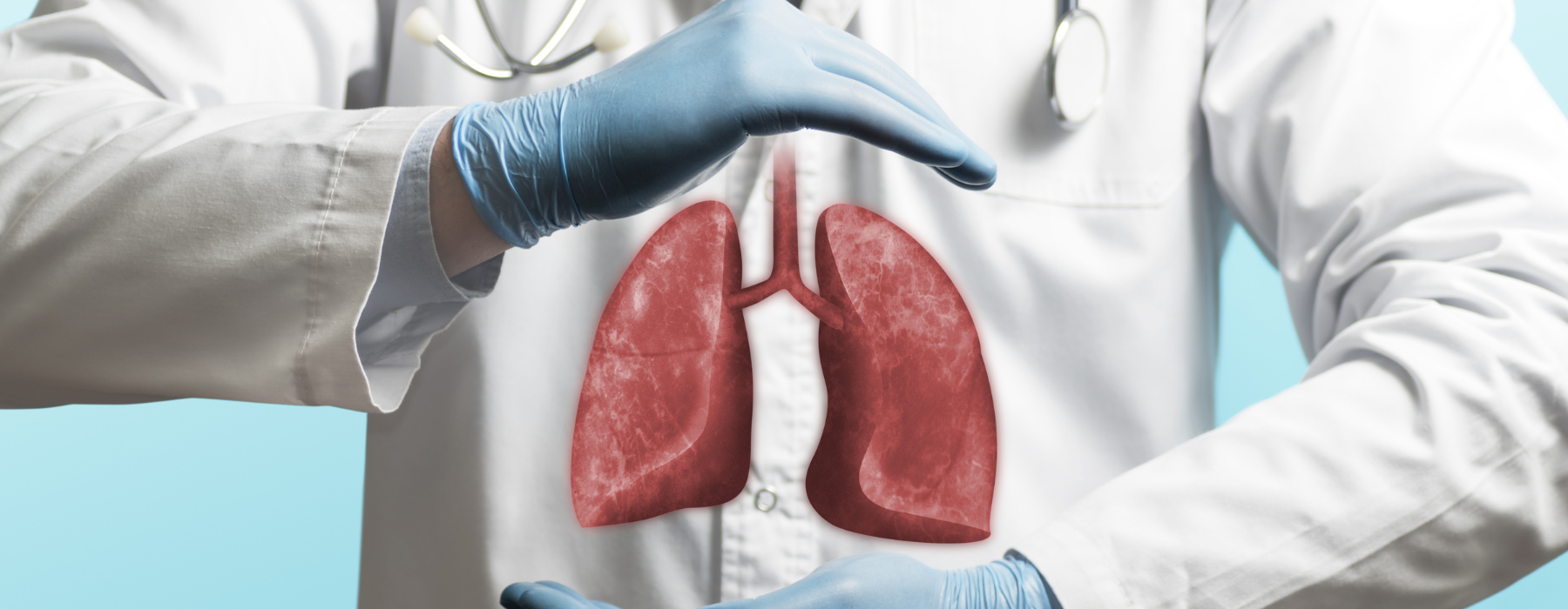 Síndrome respiratória aguda grave: o que é, sintomas, causas e tratamento
