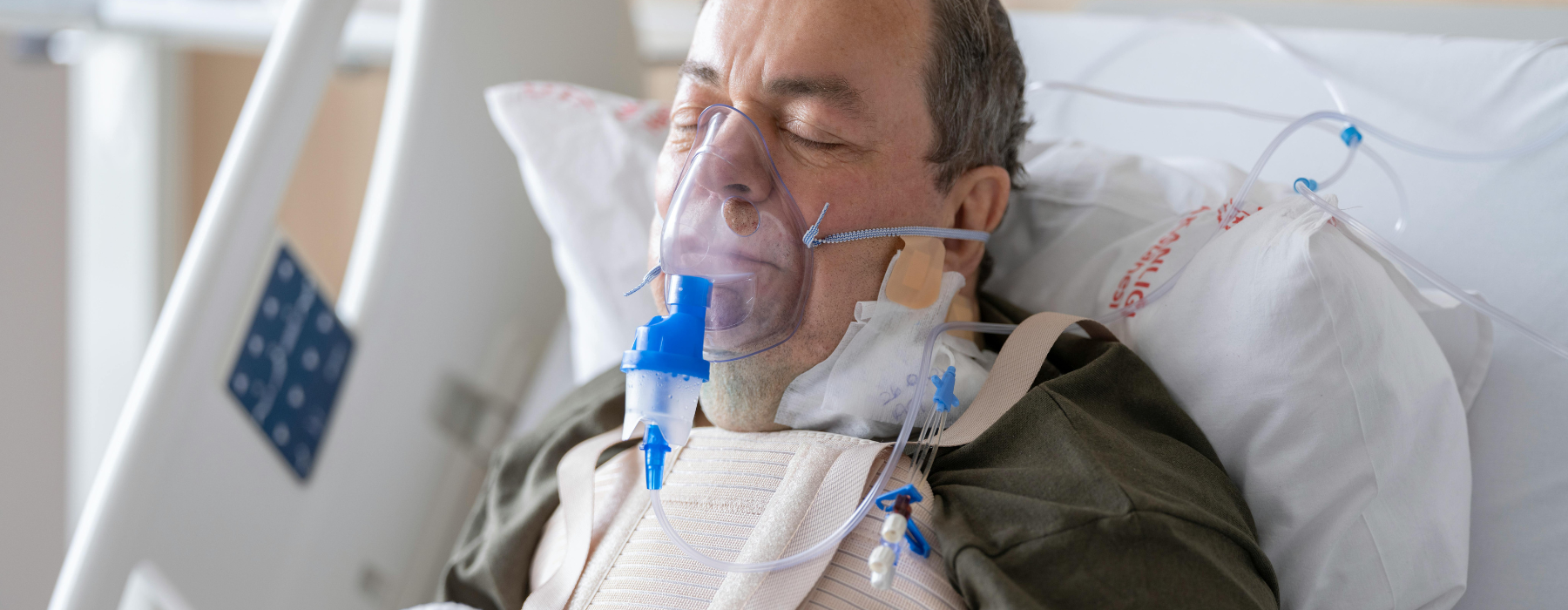 Homem deitado em leito hospitalar com máscara de oxigênio, representando tratamento da síndrome respiratória aguda grave.