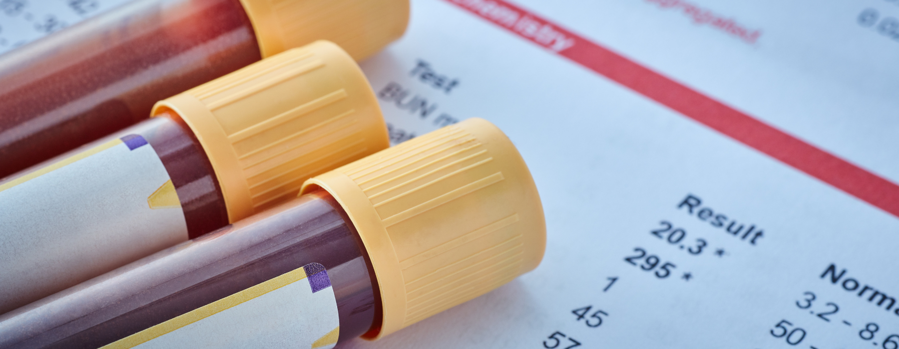 Tubos com sangue sobre um exame laboratorial com resultados numéricos.