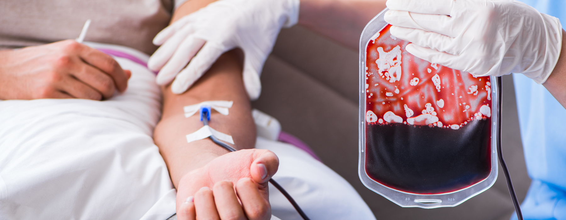  Pessoa doando sangue com a bolsa de coleta sendo segurada por profissional da saúde