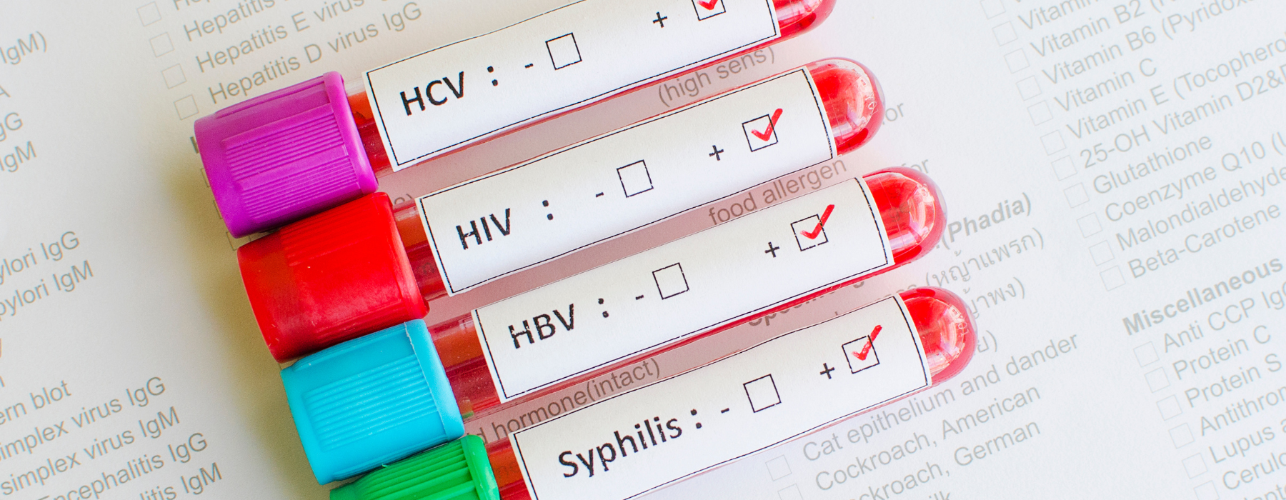 Tubos de ensaio com sangue e etiquetas indicando resultados positivos para HIV, sífilis, HBV e HCV, sobre uma ficha de exames.