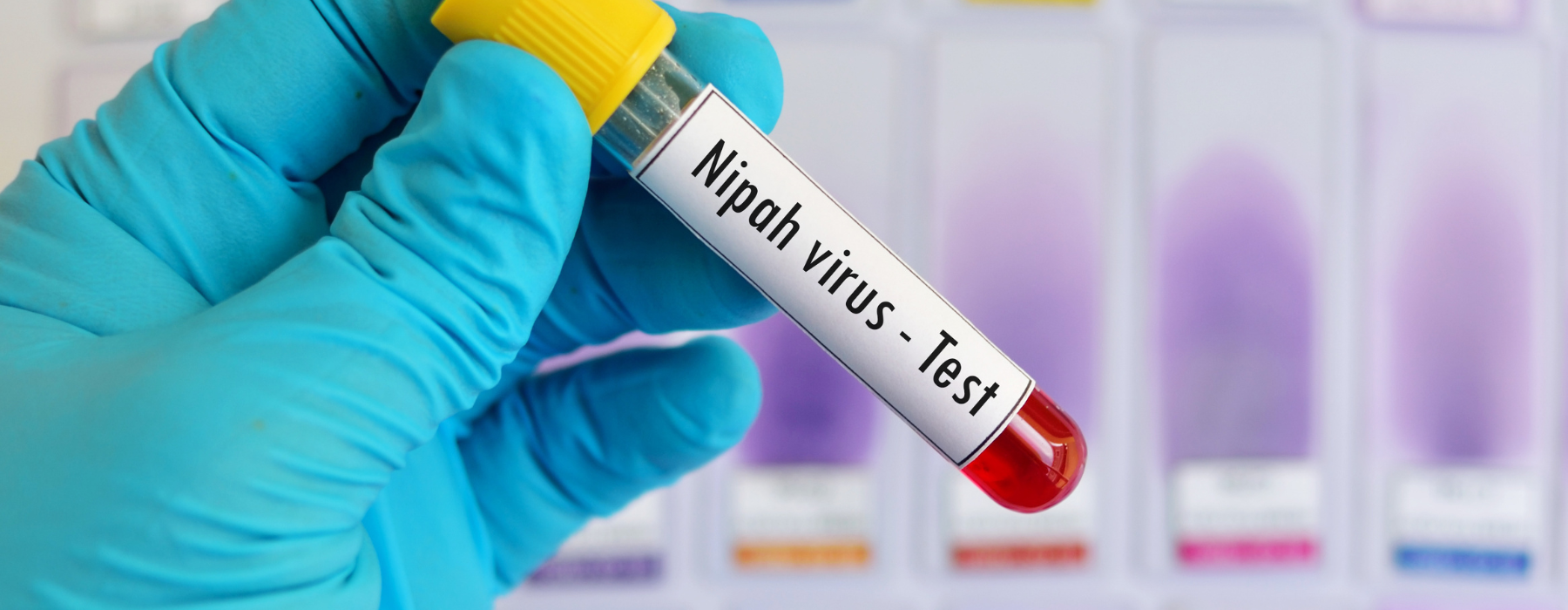 Vírus Nipah: o que é, como surgiu o atual surto na Índia e por que preocupa o mundo