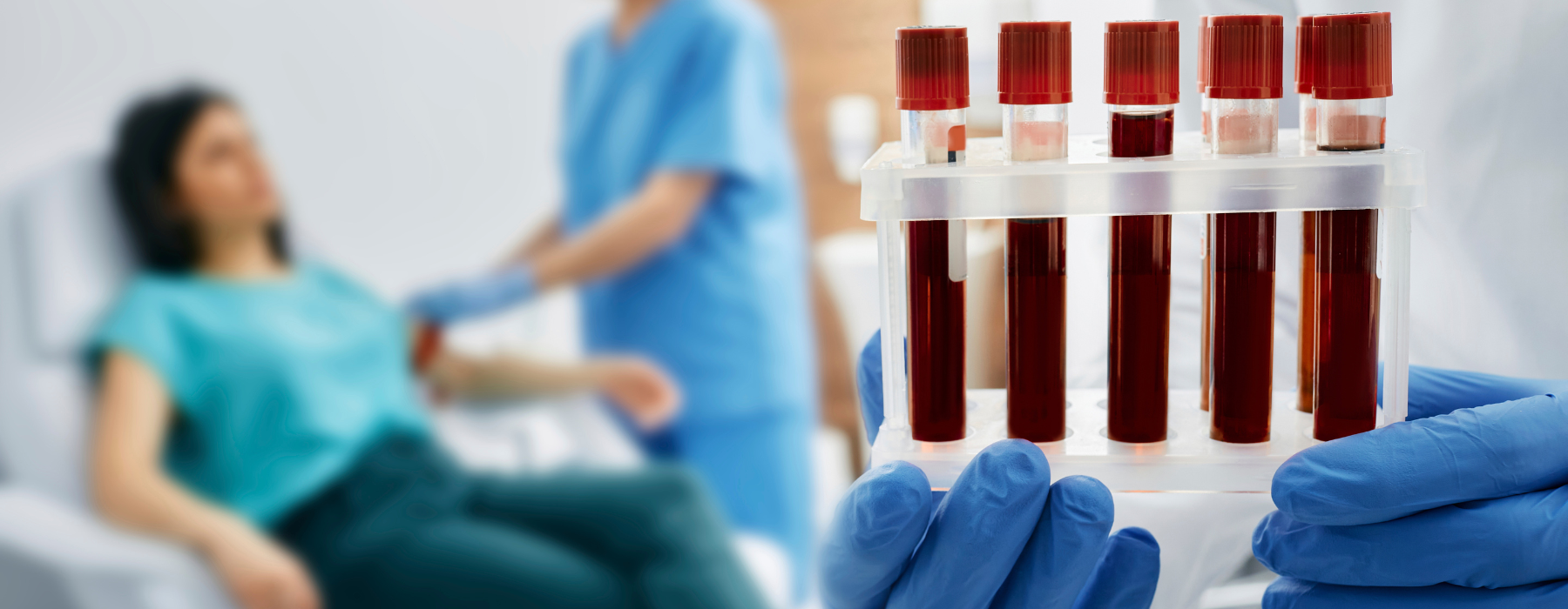Tubos de sangue para exames laboratoriais durante acompanhamento médico de paciente em tratamento.