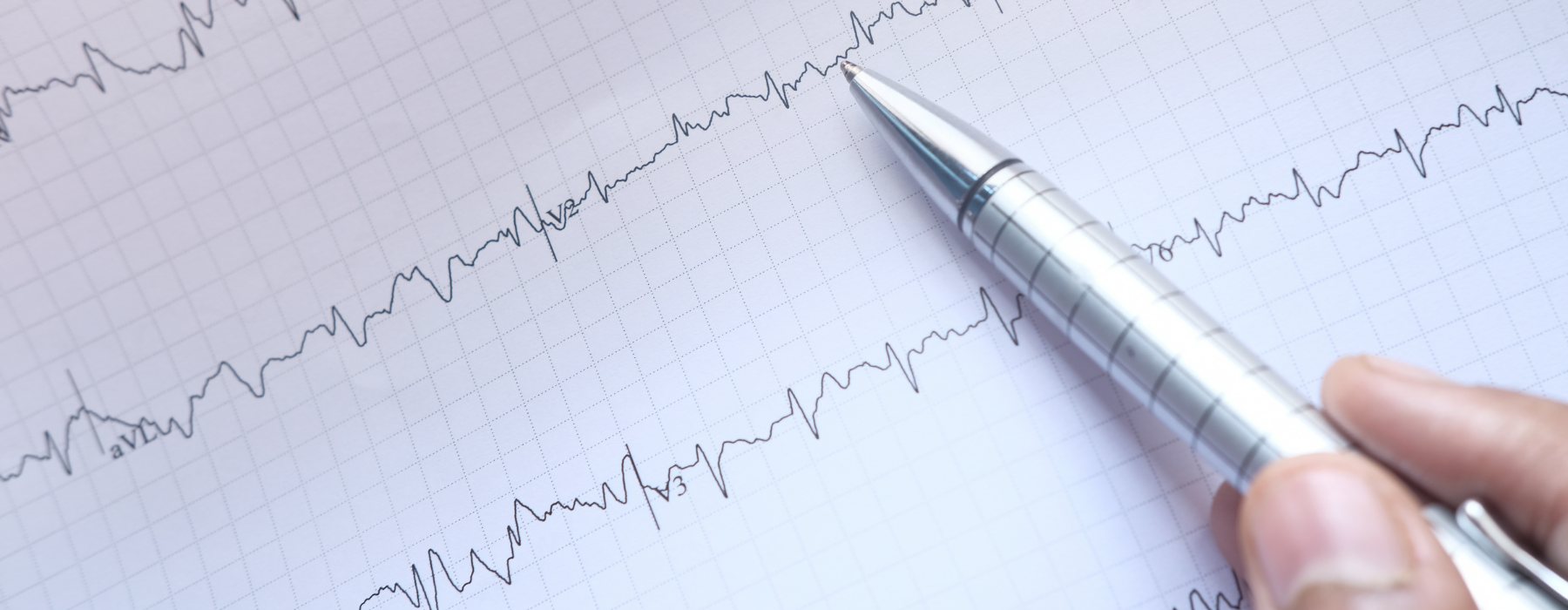 Eletrocardiograma usado na avaliação de sintomas de infarto em mulher