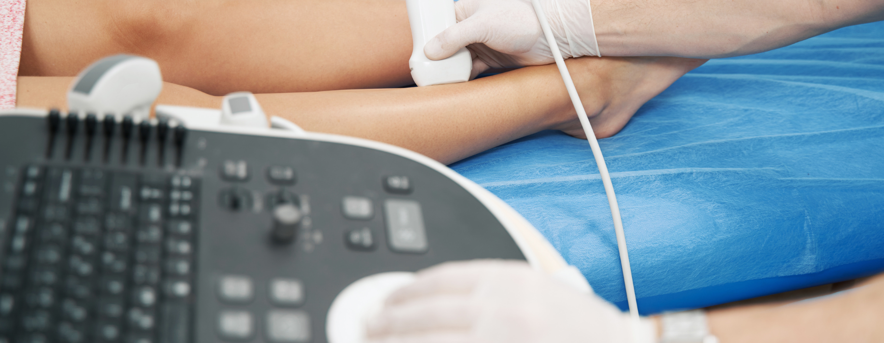 Diabetes e risco de amputação: exame de ultrassom Doppler avalia a circulação sanguínea na perna de um paciente.