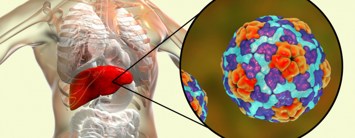 Hepatite aguda em crianças: possíveis causas