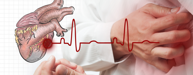 cardiomiopatia-hipertrofica